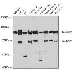 RanGAP1 Rabbit mAb