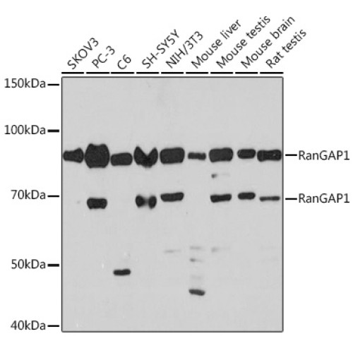 RanGAP1 Rabbit mAb