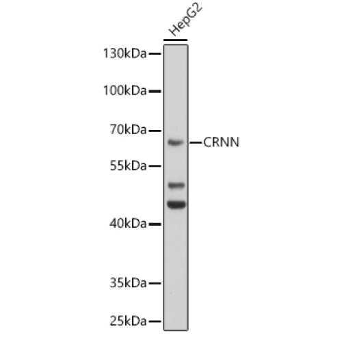 CRNN Rabbit pAb