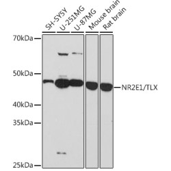 NR2E1/TLX Rabbit mAb