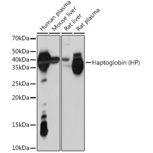 Haptoglobin (HP) Rabbit mAb