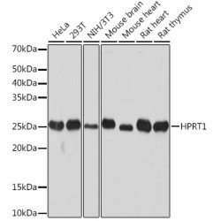 [KO Validated] HPRT1 Rabbit mAb