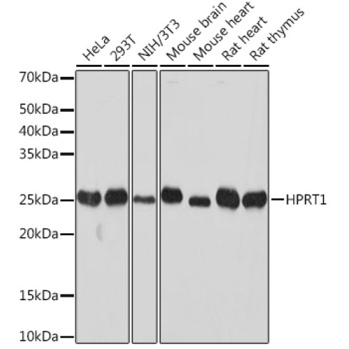 [KO Validated] HPRT1 Rabbit mAb