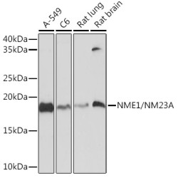 NME1/NM23A Rabbit mAb