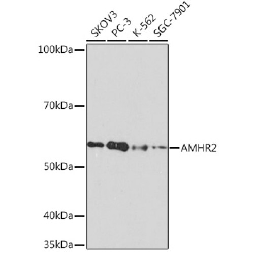 AMHR2 Rabbit mAb