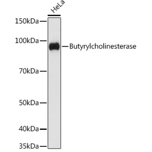 Butyrylcholinesterase Rabbit mAb