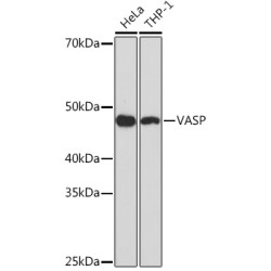 VASP Rabbit mAb