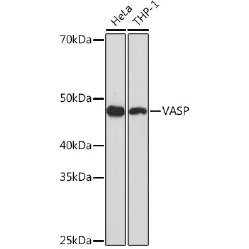 VASP Rabbit mAb