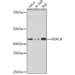 HDAC8 Rabbit mAb