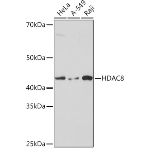 HDAC8 Rabbit mAb