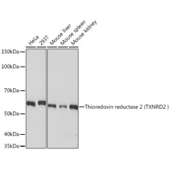 Thioredoxin reductase 2 (TXNRD2 ) Rabbit mAb