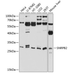 SNRPB2 Rabbit pAb