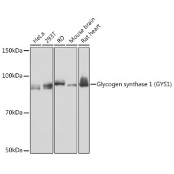 Glycogen synthase 1 (GYS1) Rabbit mAb