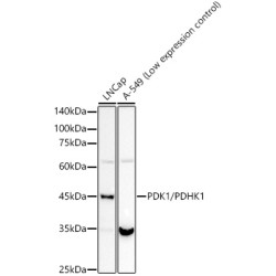 PDK1/PDHK1 Rabbit mAb
