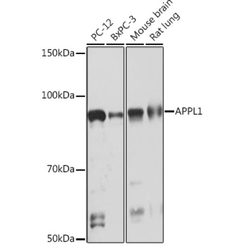 APPL1 Rabbit mAb