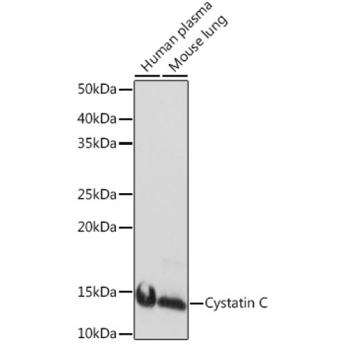Cystatin C Rabbit mAb