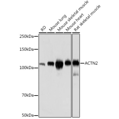 ACTN2 Rabbit mAb