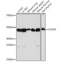 CXCR5 Rabbit mAb