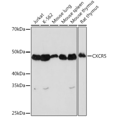 CXCR5 Rabbit mAb