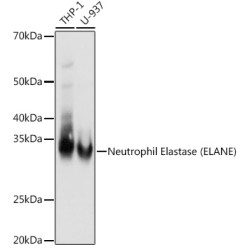 Neutrophil Elastase (ELANE) Rabbit mAb