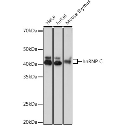 hnRNP C Rabbit mAb