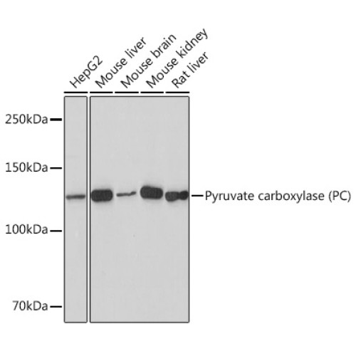 Pyruvate carboxylase (PC) Rabbit mAb