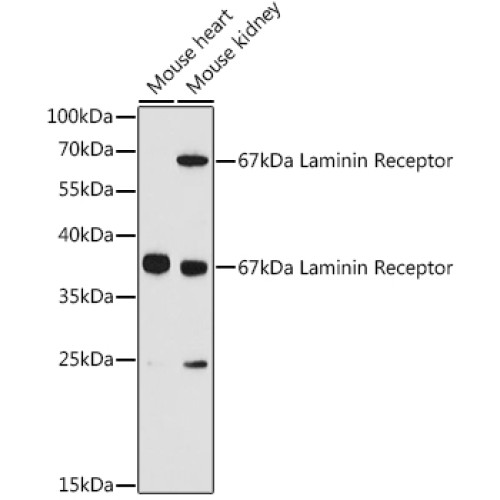 67kDa Laminin Receptor Rabbit pAb