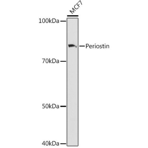 Periostin Rabbit mAb