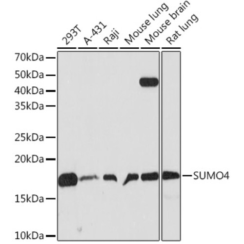 SUMO4 Rabbit mAb