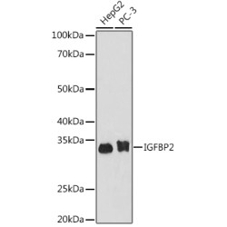 IGFBP2 Rabbit mAb