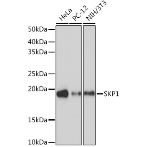 SKP1 Rabbit mAb