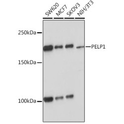 PELP1 Rabbit mAb