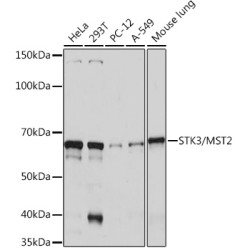 STK3/MST2 Rabbit mAb