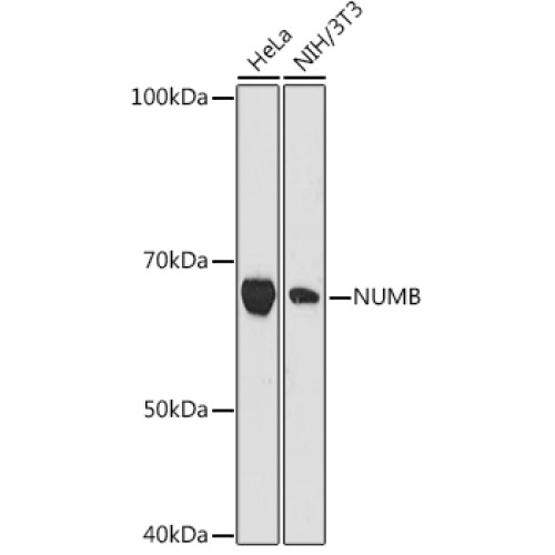 NUMB Rabbit mAb