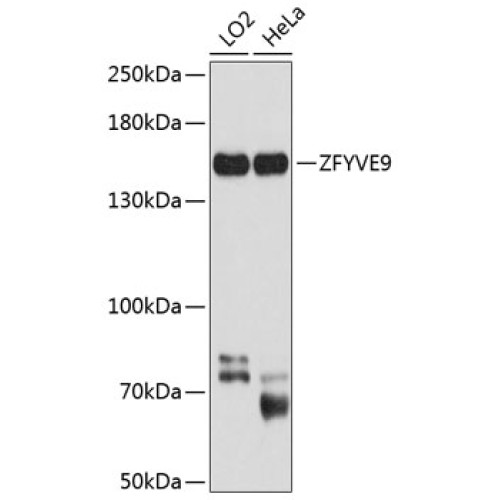 ZFYVE9 Rabbit pAb