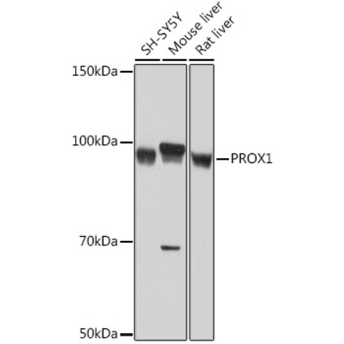 PROX1 Rabbit mAb