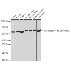 PGE receptor EP2 (PTGER2) Rabbit mAb