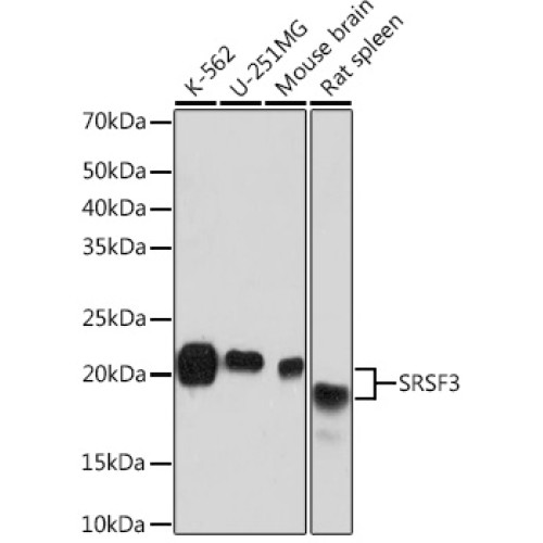 SRSF3 Rabbit mAb