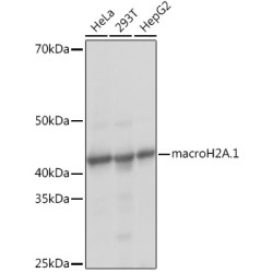 macroH2A.1 Rabbit mAb