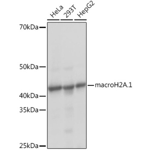 macroH2A.1 Rabbit mAb