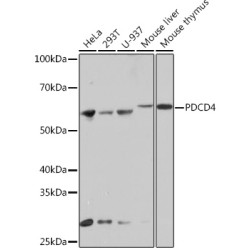 PDCD4 Rabbit mAb