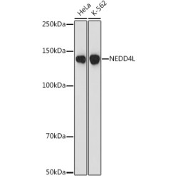 NEDD4L Rabbit mAb