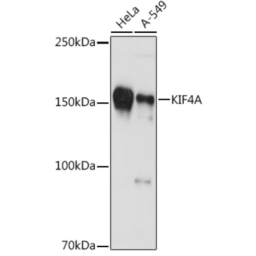 KIF4A Rabbit mAb