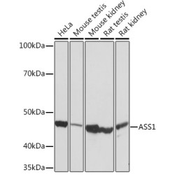 ASS1 Rabbit mAb