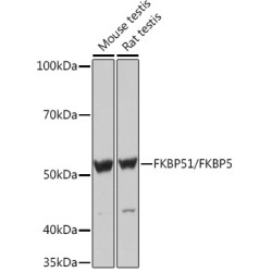 FKBP51/FKBP5 Rabbit mAb