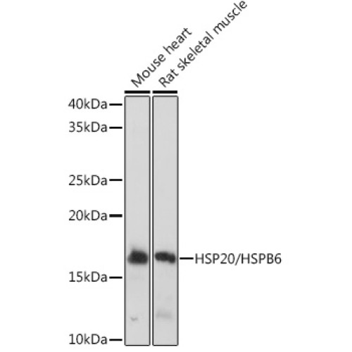 HSP20/HSPB6 Rabbit mAb