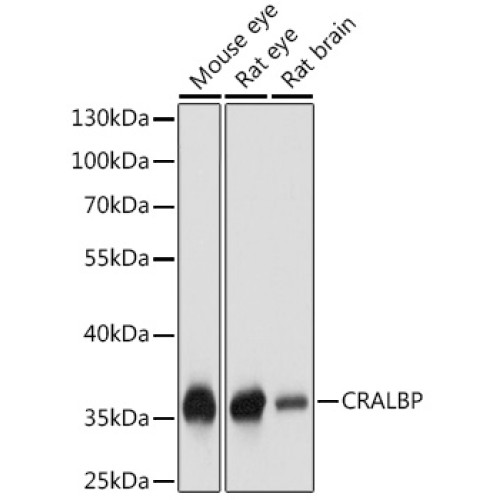 CRALBP Rabbit pAb