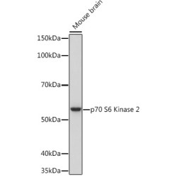 p70 S6 Kinase 2 Rabbit mAb