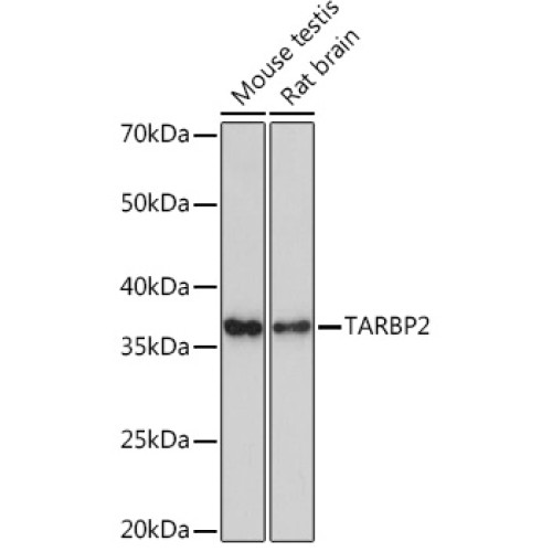 TARBP2 Rabbit mAb