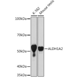 ALDH1A2 Rabbit mAb